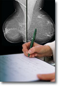 Mammographie-Aufnahme